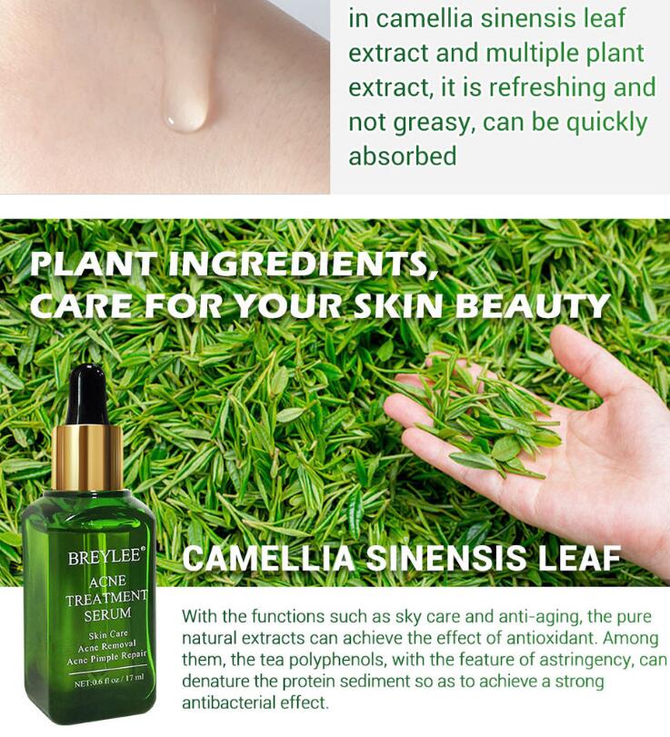 Acne Treatment Serum Facial Essence Repair Oil